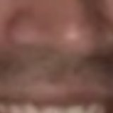 NOSE region of the source image, report CC-20260713-37F4