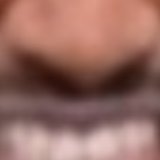 NOSE region of the target image, report CC-20260313-AA1C